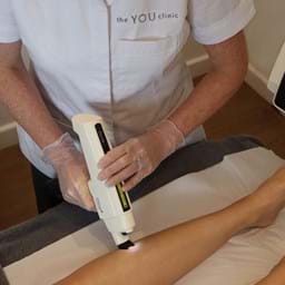 Laser Skin Rejuvenation