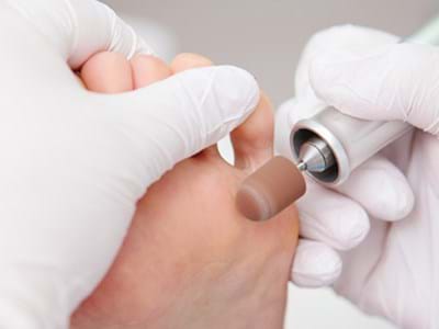 Medical Pedicure