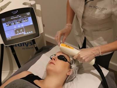 Laser Skin Rejuvenation