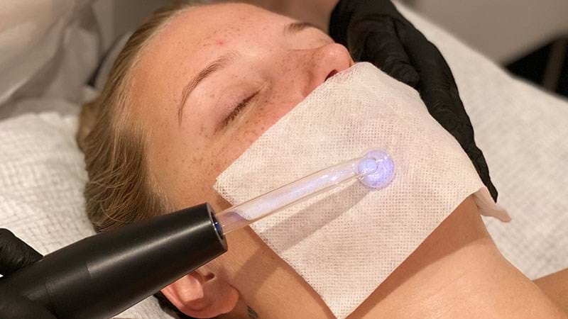 New Maskne Facial