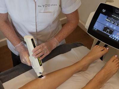 Laser Leg Vessel Treatment